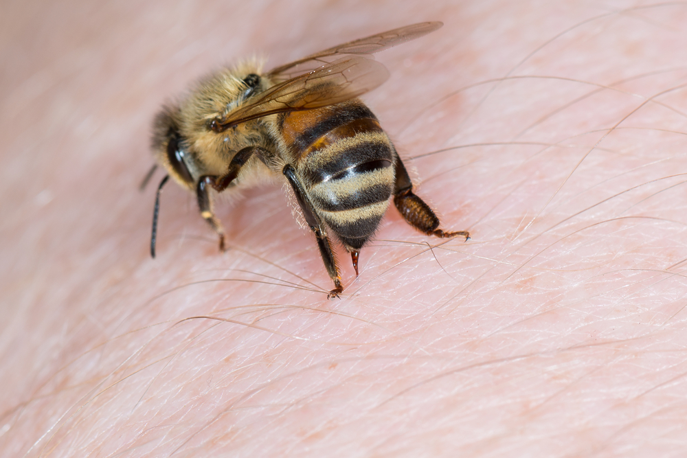 ミツバチが人を刺している様子